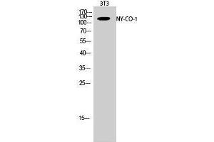 Western Blotting (WB) image for anti-serologically Defined Colon Cancer Antigen 1 (SDCCAG1) (C-Term) antibody (ABIN3185981)