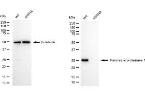Western blotting analysis using pancreatic proteinase 1 antibody (ABIN7799732). (Recombinant Pancreatic Proteinase 1 (PRT1) anticorps)
