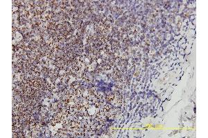 Immunoperoxidase of monoclonal antibody to PHB on formalin-fixed paraffin-embedded human tonsil tissue.