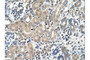 anti-Ribosomal RNA Processing 1 Homolog A (RRP1) (AA 344-393) antibody