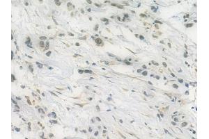 ABIN6258465 and ABIN6275072 at 1/100 staining human normal liver tissue by IHC-P. (POLR2J anticorps  (N-Term))