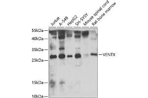 Western blot analysis of extracts of various cell lines, using VENTX antibody  at 1:1000 dilution.