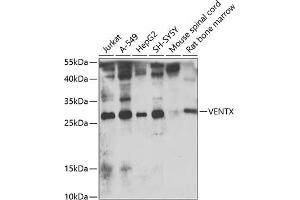 Western blot analysis of extracts of various cell lines, using VENTX antibody  at 1:1000 dilution. (VENTX anticorps  (AA 1-258))