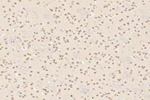 Immunohistochemistry analysis of paraffin-embedded mouse striatum using,TBXT (ABIN7075815) at dilution of 1: 3200