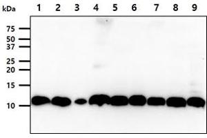 The cell lysates (40ug) were resolved by SDS-PAGE, transferred to PVDF membrane and probed with anti-human S100A11 antibody (1:1000). (S100A11 anticorps)