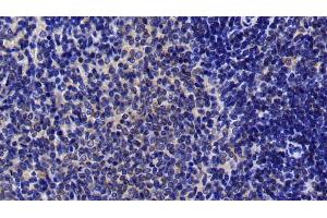 Detection of MAP2K4 in Rat Spleen Tissue using Polyclonal Antibody to Mitogen Activated Protein Kinase Kinase 4 (MAP2K4)