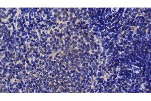 Detection of MAP2K4 in Rat Spleen Tissue using Polyclonal Antibody to Mitogen Activated Protein Kinase Kinase 4 (MAP2K4) (MAP2K4 anticorps  (AA 137-394))