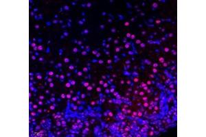 Immunohistochemistry of paraffin embedded mouse adrenal gland using Kiaa1324 (ABIN7073822) at dilution of 1:2500 (400x lens)