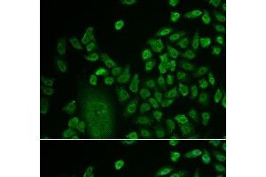 Immunofluorescence analysis of HeLa cells using LSM4 Polyclonal Antibody at dilution of 1:50. (LSM4 anticorps)