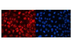 anti-Mediator Complex Subunit 18 (MED18) (AA 1-208) antibody