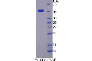 SDS-PAGE (SDS) image for P450 (Cytochrome) Oxidoreductase (POR) (AA 210-578) protein (His tag) (ABIN3209940) (POR Protein (AA 210-578) (His tag))