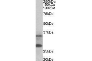Western Blotting (WB) image for anti-U6 SnRNA Biogenesis 1 (USB1) (Internal Region) antibody (ABIN2465002) (C16orf57 anticorps  (Internal Region))