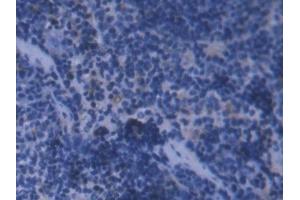 IHC-P analysis of Mouse Spleen Tissue, with DAB staining. (FTL anticorps  (AA 5-183))