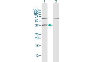 Western Blot analysis of RAD51L1 expression in transfected 293T cell line by RAD51L1 MaxPab polyclonal antibody. (RAD51 Homolog B anticorps  (AA 1-384))