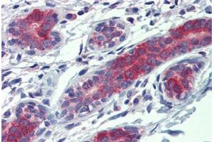 Human Breast: Formalin-Fixed, Paraffin-Embedded (FFPE)