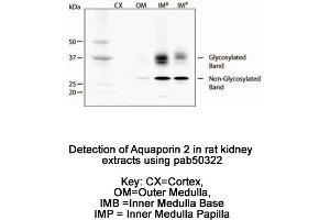 Image no. 1 for anti-Aquaporin 2 (Collecting Duct) (AQP2) (AA 200-300), (C-Term) antibody (ABIN363631)