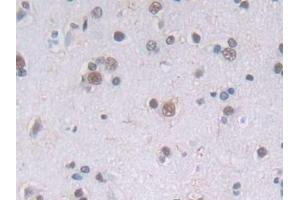 Detection of PLCg1 in Human Cerebrum Tissue using Polyclonal Antibody to Phospholipase C Gamma 1 (PLCg1)