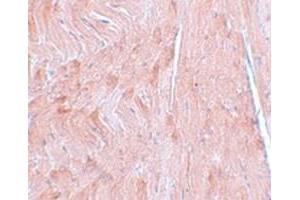 Immunohistochemical staining of mouse heart tissue with REEP3 polyclonal antibody  at 5 ug/mL dilution. (REEP3 anticorps  (C-Term))