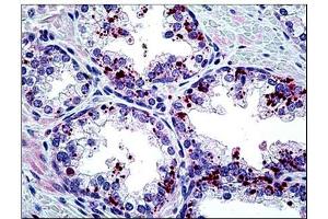 Human Prostate: Formalin-Fixed, Paraffin-Embedded (FFPE) (ARTN anticorps  (Internal Region))