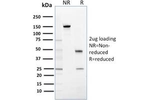 SDS-PAGE Analysis Purified Stratifin Mouse Monoclonal Antibody (CPTC-SFN-2).