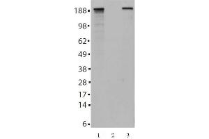 Tes2 mAb (Clone 21F11) tested by Western blot. (TET2 anticorps  (AA 1-300))