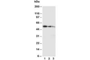 Western blot testing with Ki-67 antibody and partial human recombinant protein (Ki-67 anticorps  (C-Term))