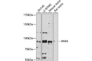 Western blot analysis of extracts of various cell lines, using RNF6 antibody (ABIN7270075) at 1:1000 dilution. (RNF6 anticorps  (AA 1-300))