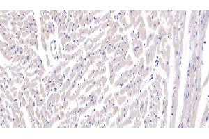 Detection of SFRP1 in Rat Cardiac Muscle Tissue using Polyclonal Antibody to Secreted Frizzled Related Protein 1 (SFRP1) (SFRP1 anticorps  (AA 8-153))