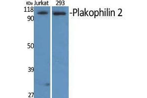 Western Blot (WB) analysis of Jurkat and 293 cells using Plakophilin 2 Polyclonal Antibody. (Plakophilin 2 anticorps  (C-Term))