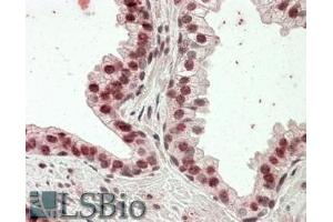 ABIN570834 (3. (Homeobox D13 anticorps  (Internal Region))
