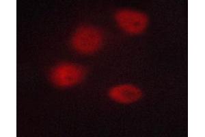 ABIN6267233 staining A549 cells by ICC/IF. (HDAC3 anticorps  (pSer424))