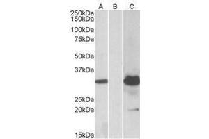 HEK293 lysate (10 µg protein in RIPA buffer) overexpressing Human KCTD11 with DYKDDDDK tag probed with AP23752PU-N (1. (KCTD11 anticorps  (Internal Region))