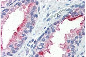 Human Prostate (formalin-fixed, paraffin-embedded) stained with FOLH1 antibody ABIN364300 at 10 ug/ml followed by biotinylated anti-mouse IgG secondary antibody ABIN481714, alkaline phosphatase-streptavidin and chromogen. (PSMA anticorps)