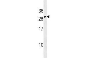 Erythropoietin antibody western blot analysis in CEM lysate. (EPO anticorps  (AA 155-184))