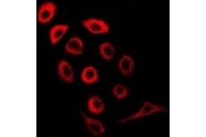 Immunofluorescent analysis of PDE1B staining in MCF7 cells. (PDE1B anticorps)
