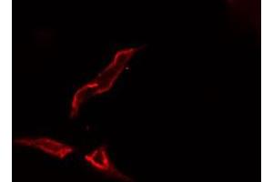 ABIN6276650 staining  Hela cells by IF/ICC. (TYR anticorps  (C-Term))
