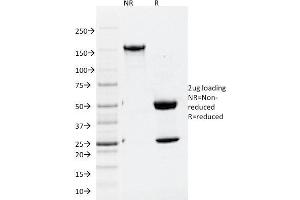 SDS-PAGE Analysis Purified ATG5 Mouse Monoclonal Antibody (ATG5/2101).