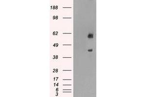 HEK293T cells were transfected with the pCMV6-ENTRY control (Left lane) or pCMV6-ENTRY PPP1R7 (Right lane) cDNA for 48 hrs and lysed.