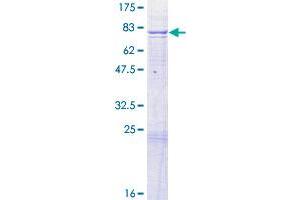 Image no. 1 for AarF Domain Containing Kinase 4 (ADCK4) (AA 1-503) protein (GST tag) (ABIN1305944)
