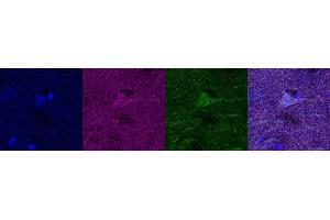 Immunohistochemistry (IHC) image for anti-Ubiquitin Carboxyl-terminal Esterase L1 (Ubiquitin Thiolesterase) (UCHL1) antibody (ABIN7456137) (UCHL1 anticorps)