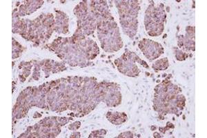 Image no. 1 for anti-Pleckstrin Homology Domain Containing, Family F (With FYVE Domain) Member 2 (PLEKHF2) (AA 60-249) antibody (ABIN1500276)