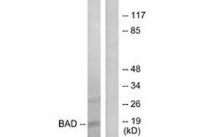 Western blot analysis of extracts from 293 cells, treated with Forskolin, using BAD (Ab-136) Antibody. (BAD anticorps  (AA 102-151))