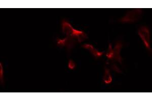 ABIN6274882 staining COLO205 by IF/ICC. (ABCB10 anticorps  (Internal Region))
