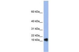 Image no. 1 for anti-Ribonuclease, RNase A Family, 1 (Pancreatic) (RNASE1) (N-Term) antibody (ABIN6742978) (RNASE1 anticorps  (N-Term))