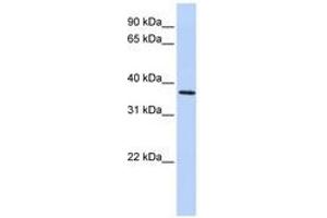 Image no. 1 for anti-F-Box Protein 8 (FBXO8) (AA 216-265) antibody (ABIN6741269) (FBXO8 anticorps  (AA 216-265))
