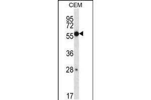 Western blot analysis in CEM cell line lysates (35ug/lane). (ZNF764 anticorps  (AA 84-113))