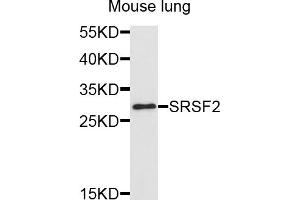 Western blot analysis of extracts of mouse lung, using SRSF2 antibody (ABIN5995581) at 1/1000 dilution.