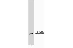 Western blot analysis of p21. (p21 anticorps)