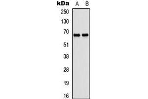 Western blot analysis of ATG16L1 expression in SHSY5Y (A), rat muscle (B) whole cell lysates. (ATG16L1 anticorps  (Center))
