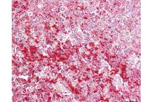 Anti-ETV5 antibody IHC of human spleen.